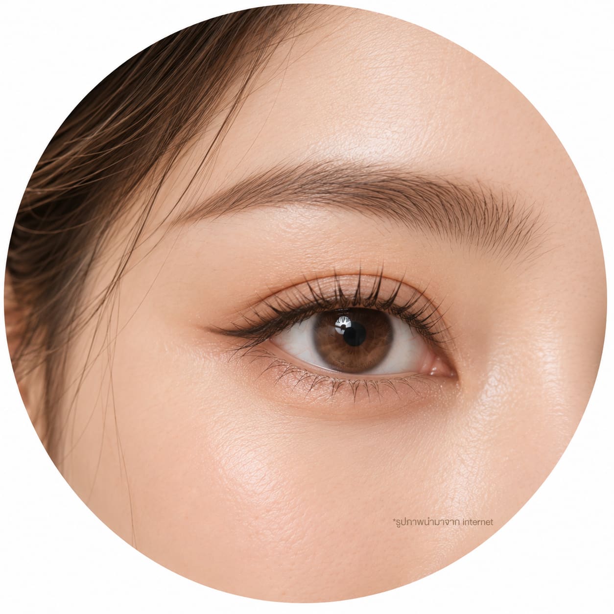 Program Eye Surgery