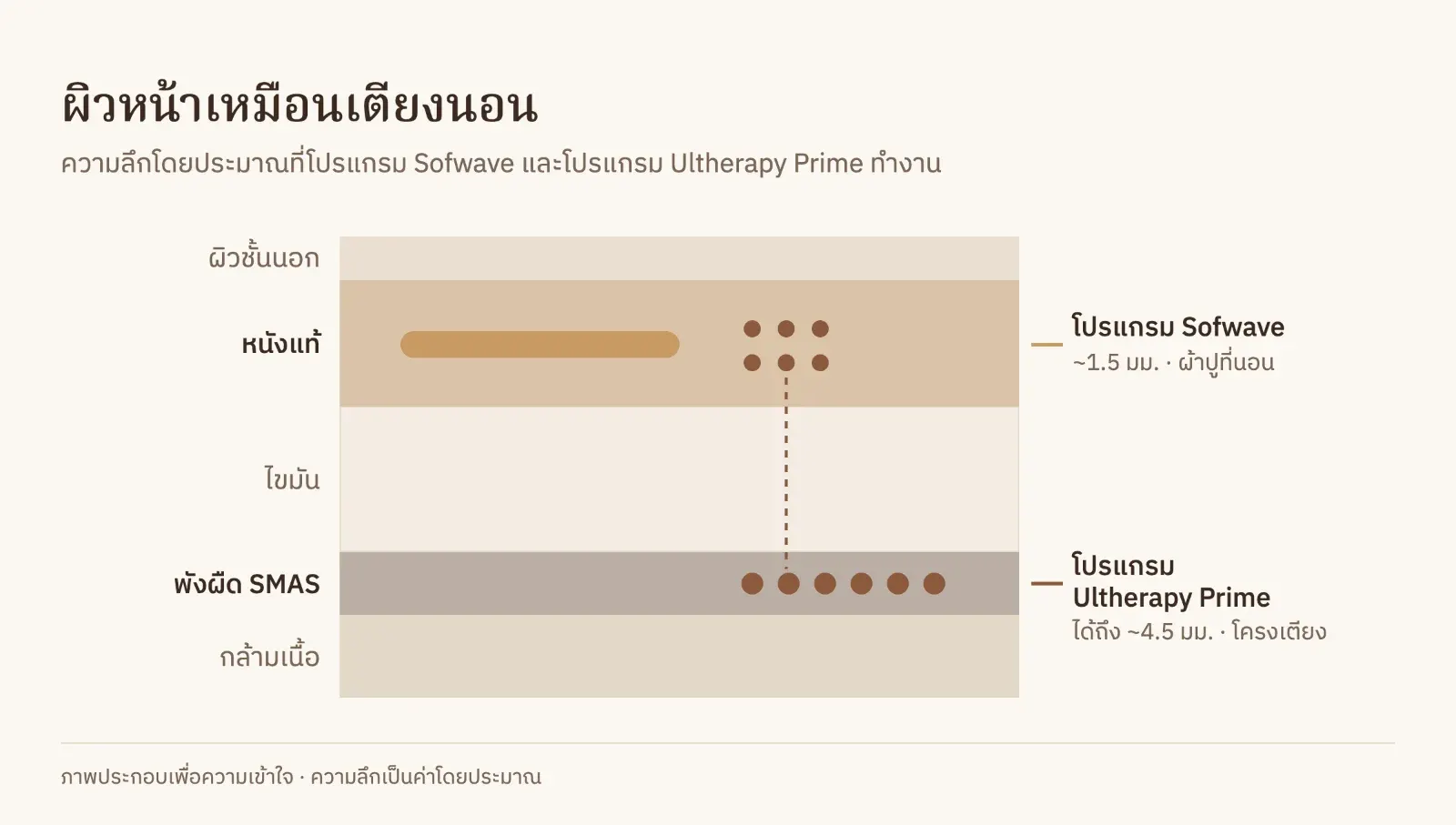 แผนภาพชั้นผิว: โปรแกรม Ulthera Prime ลงได้ถึงชั้นพังผืด SMAS ประมาณ 4.5 มม. เทียบกับโปรแกรม Sofwave ที่ชั้นหนังแท้ประมาณ 1.5 มม.